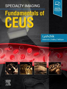 Specialty Imaging: Fundamentals of CEUS - 2869946911