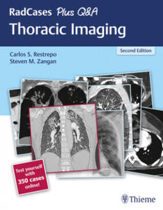 RadCases Plus Q&A Thoracic Imaging - 2869754029