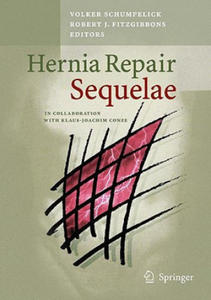 Hernia Repair Sequelae - 2868820705