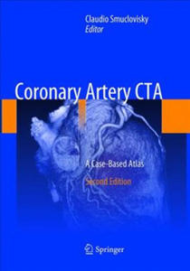 Coronary Artery CTA - 2878628309