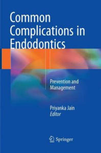 Common Complications in Endodontics - 2877617181