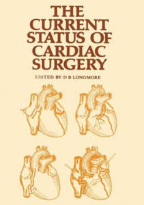 Current Status of Cardiac Surgery - 2867121687