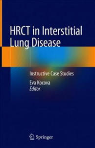 HRCT in Interstitial Lung Disease - 2877636418