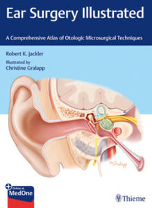 Ear Surgery Illustrated - 2876548389