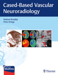 Imaging in Neurovascular Disease - 2876031963