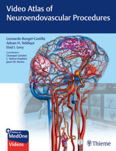 Video Atlas of Neuroendovascular Procedures - 2874294284
