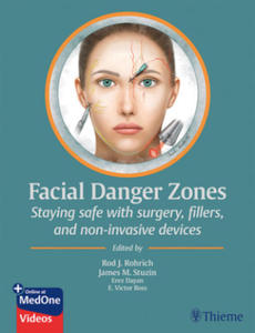 Facial Danger Zones - 2877770285