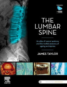 Lumbar Spine - 2877043468