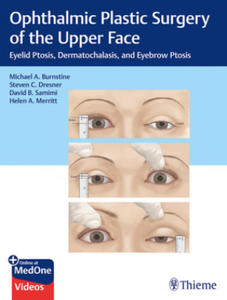 Ophthalmic Plastic Surgery of the Upper Face - 2869952157