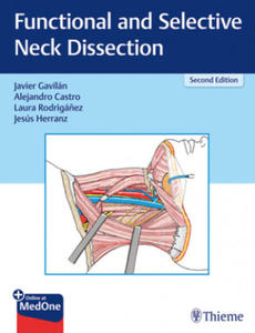 Functional and Selective Neck Dissection - 2877859317