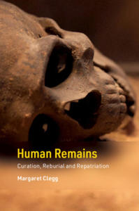 Human Remains - 2871412587