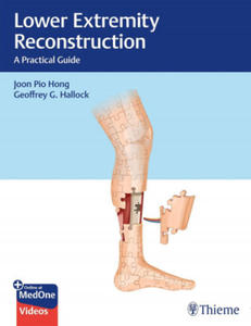 Lower Extremity Reconstruction - 2874287744