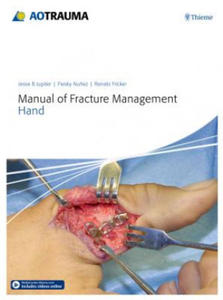 Manual of Fracture Management - Hand - 2861986989