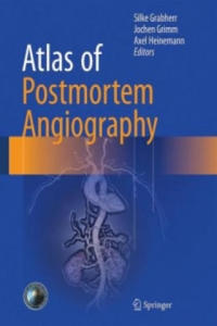 Atlas of Postmortem Angiography - 2867130389