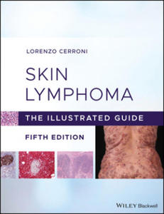 Skin Lymphoma - 2865537385