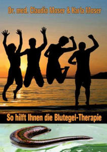 So hilft ihnen die Blutegeltherapie - 2874537157