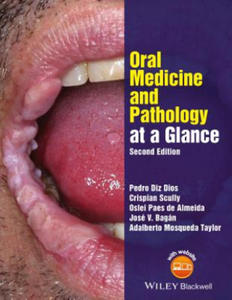 Oral Medicine and Pathology at a Glance 2e - 2867759278