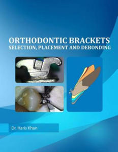 Orthodontic Brackets - 2871701724