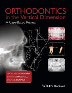 Orthodontics in the Vertical Dimension - A Case-Based Review - 2854199309