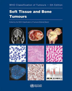 WHO classification of tumours of soft tissue and bone tumours - 2878296193