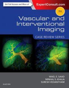 Vascular and Interventional Imaging: Case Review Series - 2864200651