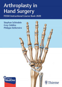 Arthroplasty in Hand Surgery - 2875672717