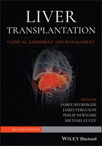 Liver Transplantation - Clinical Assessment and Management, 2nd edition - 2865371323