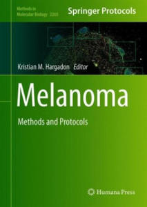 Melanoma - 2867139260