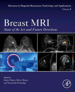 Breast MRI - 2874783391