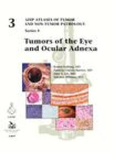 Tumors of the Eye and Ocular Adnexa - 2873897767