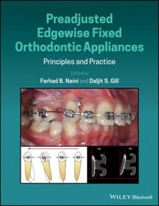 Preadjusted Edgewise Fixed Orthodontic Appliances - Principles and Practice - 2867759105