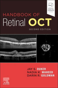 Handbook of Retinal OCT: Optical Coherence Tomography - 2872201609