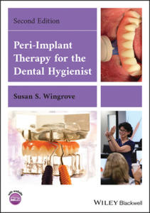 Peri-Implant Therapy for the Dental Hygienist - 2872349826
