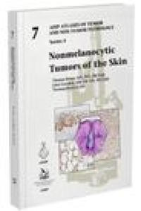 Nonmelanocytic Tumors of the Skin - 2877041196