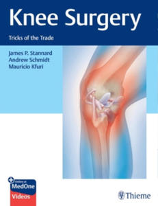 Knee Surgery - 2869039149