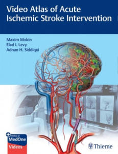 Video Atlas of Acute Ischemic Stroke Intervention - 2871147350