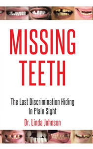 Missing Teeth - 2867774218