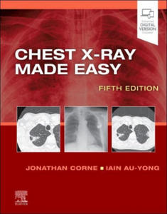 Chest X-Ray Made Easy - 2869039058