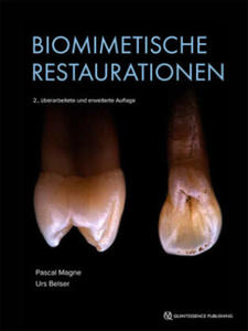Biomimetische Restaurationen - 2878878257