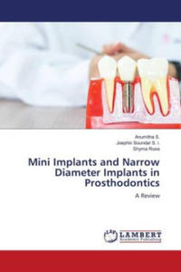 Mini Implants and Narrow Diameter Implants in Prosthodontics - 2877606463