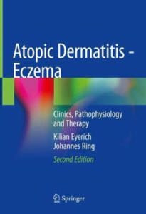 Atopic Dermatitis - Eczema - 2875338848