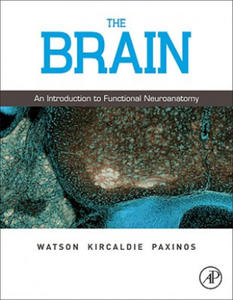 Charles Watson - Brain - 2854258010