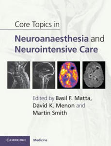 Core Topics in Neuroanaesthesia and Neurointensive Care - 2877180271