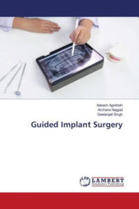 Guided Implant Surgery - 2872212726