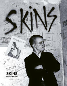 Skins: Gavin Watson - 2878324410