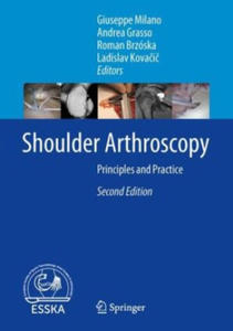 Shoulder Arthroscopy - 2875540860