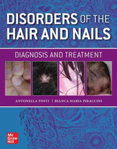 Disorders of the Hair and Nail: Diagnosis and Treatment - 2875914004