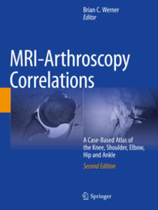 MRI-Arthroscopy Correlations - 2878085242