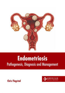 Endometriosis: Pathogenesis, Diagnosis and Management - 2877407774