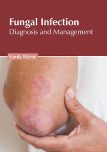 Fungal Infection: Diagnosis and Management - 2876123422